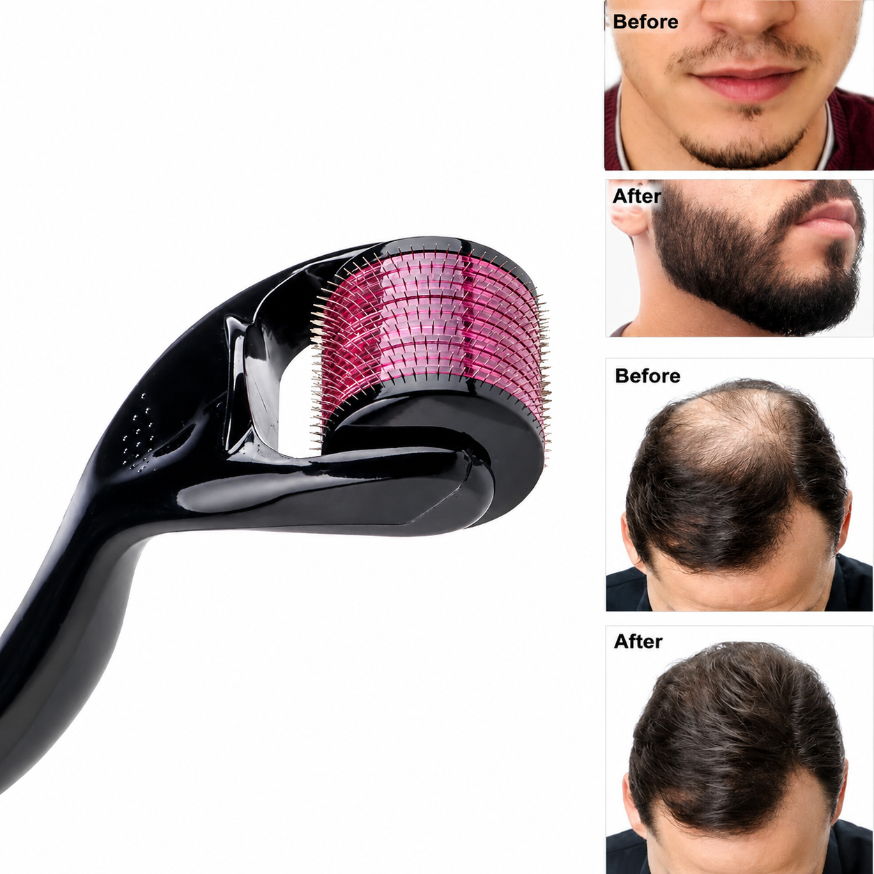 Skin Care Derma Roller Tool | أداة ديرما رولر للعناية بالبشرة