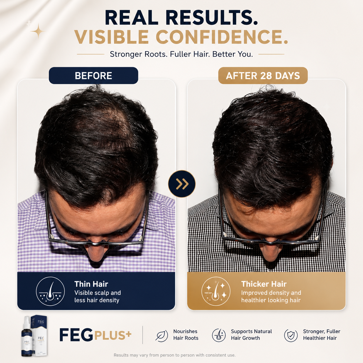 Hair Regrowth Spray + Free Microneedling Roller | بخاخ نمو الشعر مع ديرما رولر