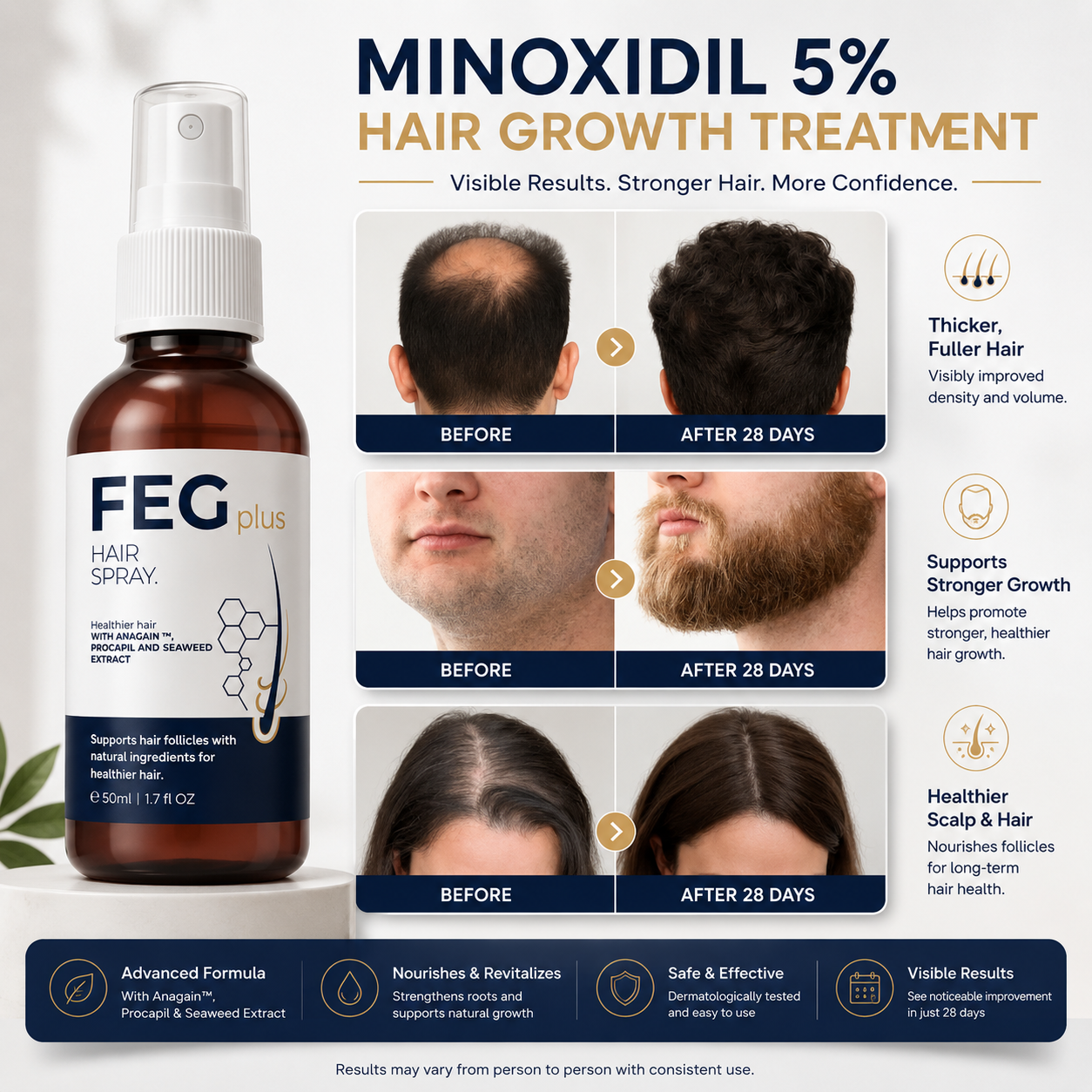 Hair Regrowth Spray + Free Microneedling Roller | بخاخ نمو الشعر مع ديرما رولر